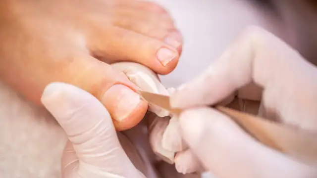 Wrastający paznokieć: Domowe leczenie i kiedy szukać pomocy eksperta?