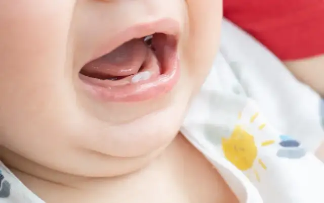 Ząbkowanie niemowlaka: Objawy, dziąsła, ulga. Kiedy do lekarza?