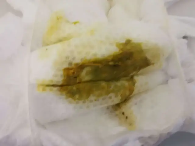 Jak wyglądają kupki przy ząbkowaniu? Co powinno niepokoić rodziców?