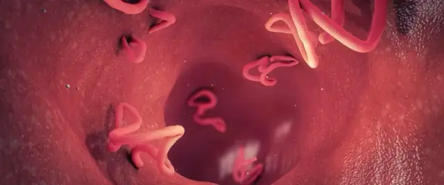 Robaki u dziecka objawy: Jak rozpoznać i uniknąć problemów zdrowotnych