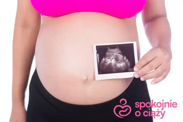 Płeć dziecka: Kiedy i jak poznać? Metody i pewność od 10. tyg.