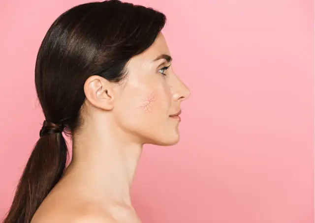 Kwas laktobionowy: Jak odmieni skórę wrażliwą, naczynkową, dojrzałą?