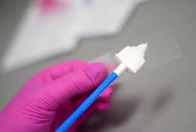 Cytologia grupa 3: Nie rak! Co dalej i jak skutecznie leczyć?