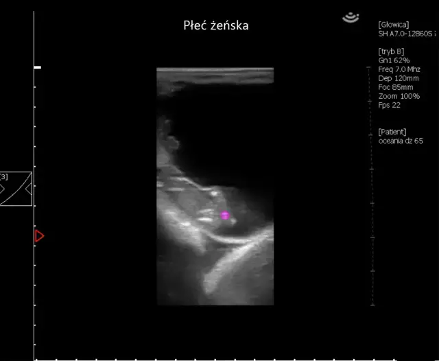 Jak rozpoznać ciążę u konia: objawy i metody diagnozowania