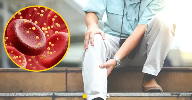 Wysoki cholesterol: Cichy zabójca. Poznaj skutki dla zdrowia!