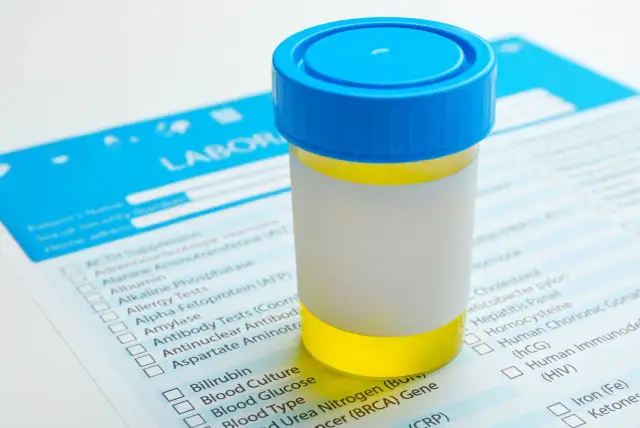 Mocz niemowlaka: Jak pobrać i przechowywać bezbłędnie?