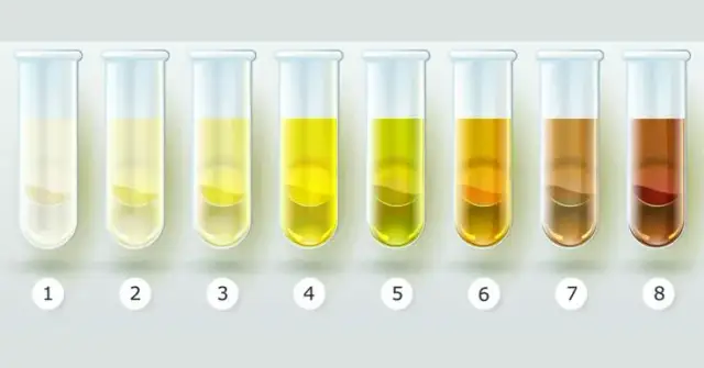Jasny kolor moczu: Co oznacza jasny kolor moczu? Sprawdź!