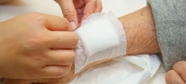 Do jakiego lekarza z oparzeniem? Kiedy iść do specjalisty, by uniknąć powikłań