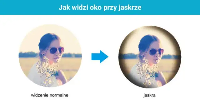 Jak jaskra wpływa na widzenie i co możesz z tym zrobić?