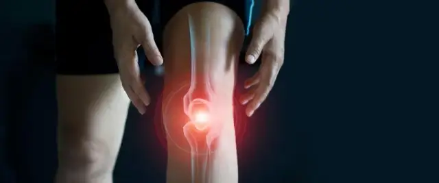 Skręcone kolano? Rozpoznaj objawy, stopnie urazu i działaj szybko!