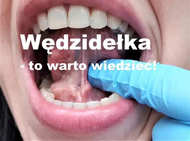 Kiedy zacząć ćwiczyć po podcięciu wędzidełka, aby uniknąć problemów?