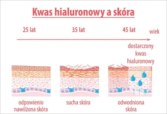 W czym jest najwięcej kwasu hialuronowego w naszej skórze?