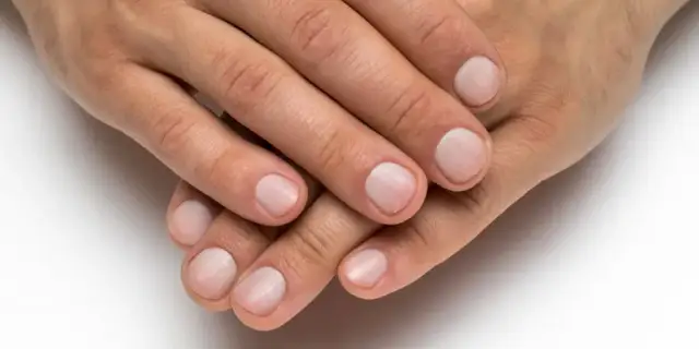 Co mogą oznaczać podłużne bruzdy na paznokciach i ich zdrowotne skutki