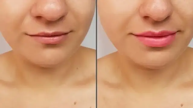 Czy błyszczyk powiększający usta działa? Oto prawda o efektach