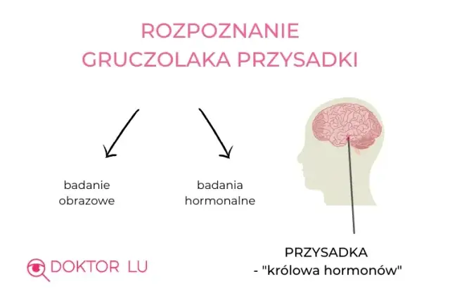 Gruczolak przysadki a psychika: objawy, leczenie, wsparcie