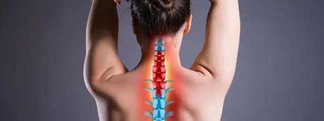 Skręcenie kręgosłupa szyjnego - ile trwa leczenie i co wpływa na powrót do zdrowia