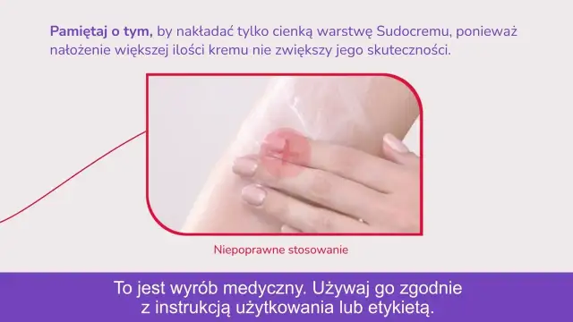 Sudocrem na pryszcze: czy warto? Opinie, skład i skuteczne alternatywy