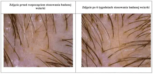 Co daje masaż głowy? Odkryj sekrety zdrowych włosów i relaksu