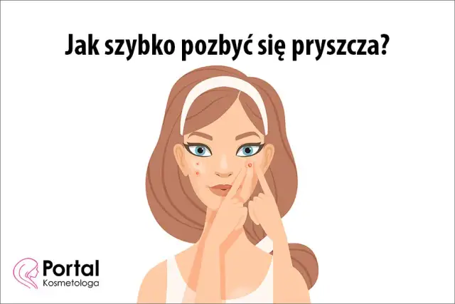Jak szybko zmniejszyć pryszcza? Skuteczne sposoby i błędy