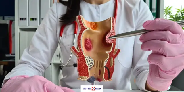 Hemoroidy: Do którego lekarza się udać? Proktolog czy rodzinny?