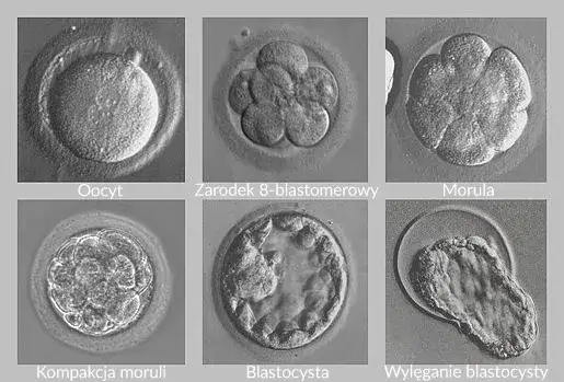 Kiedy płód jest dzieckiem? Zaskakujące etapy rozwoju ciąży