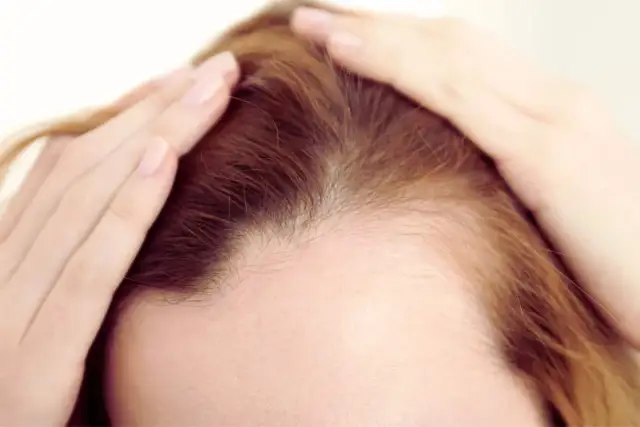 Zatrzymaj wypadanie włosów! Diagnoza, dieta, pielęgnacja ekspert radzi