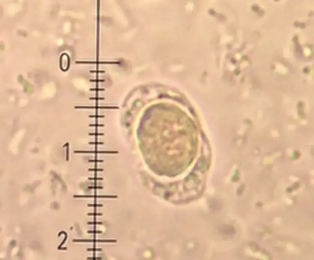 Blastocystis hominis - charakterystyka, objawy i naturalne leczenie