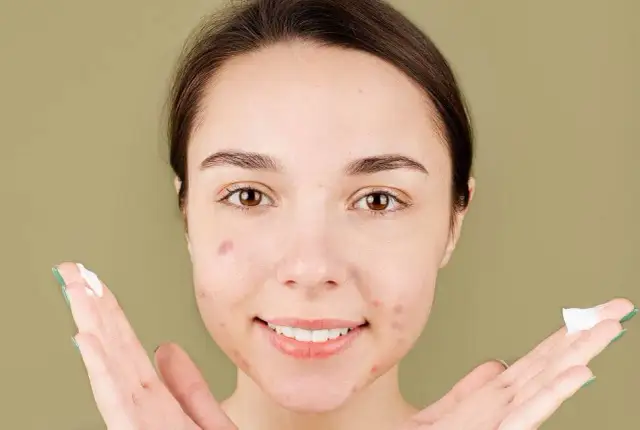 Czy wyciskanie pryszczy jest zdrowe? Poznaj ryzyka i skutki dla skóry