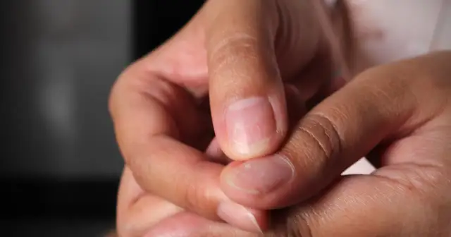 Jak wyglądają paznokcie po zdjęciu hybrydy? Oto zaskakujące efekty