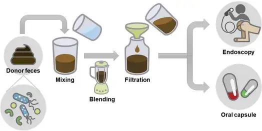 Badanie mikrobioty jelitowej - na czym polega procedura?