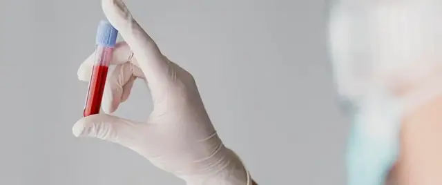 OB (Odczyn Biernackiego): Co oznacza Twój wynik? Pełny przewodnik