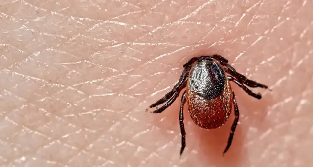 Jakie badanie na boreliozę? Kluczowe informacje, które musisz znać