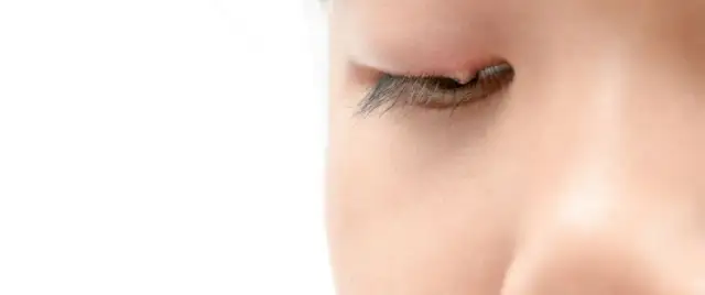 Jakie leki na jęczmień na oku skutecznie złagodzą objawy?