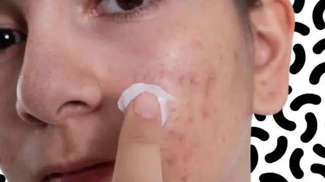 Tołpa Estetic Trądzik: Opinie, Skład i Efekty. Czy warto?