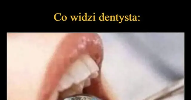 Co widzi dentysta? Pełny obraz Twojego zdrowia z ust