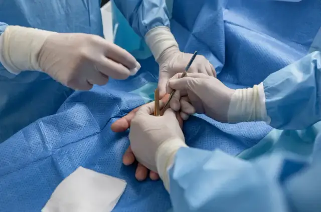 Chirurg ręki: Jak wybrać najlepszą klinikę i specjalistę?