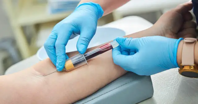 Kiedy zrobić próby wątrobowe w ciąży? Objawy, które mogą zaskoczyć