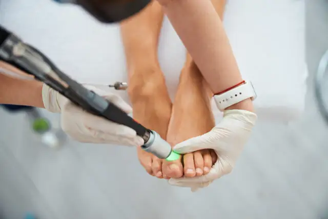 Kiedy chodzić po operacji haluksa? Twój plan powrotu do sprawności