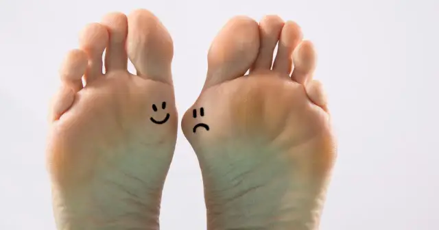 Jodyna na haluksy? Ortopeda obala mit i radzi, co działa!