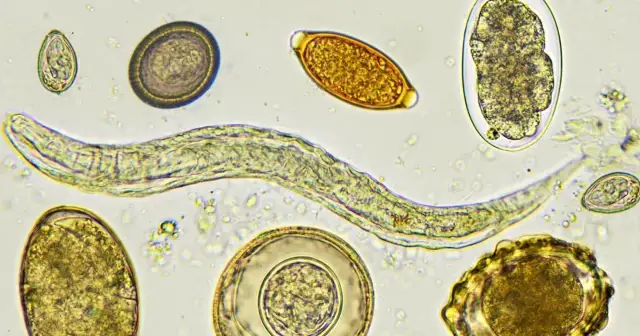 Objawy odrobaczania: Co powinieneś wiedzieć o skutkach ubocznych