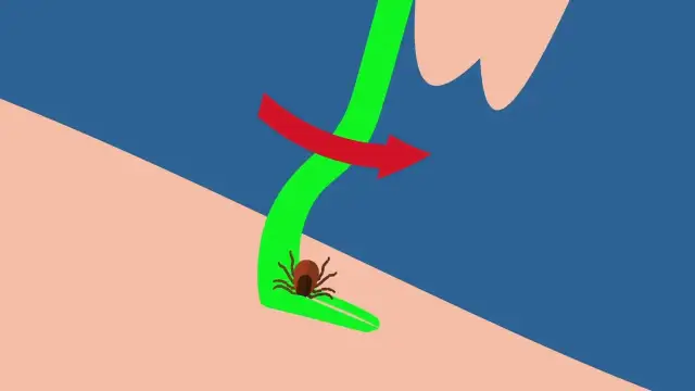 Czym wyciągnąć kleszcza? Najlepsze metody na bezpieczne usunięcie