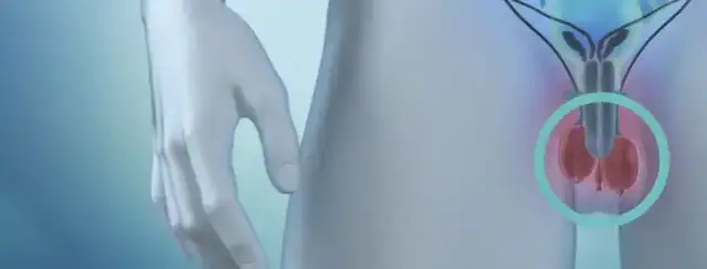 USG jąder: Czy naprawdę trzeba golić przed badaniem?