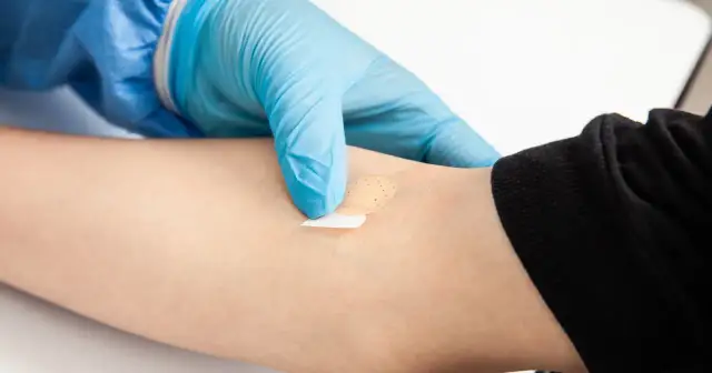 Ręka w niebieskiej rękawiczce zakłada plaster na ramię. Może to być związane z badaniem poziomu kortyzolu i jego objawami.