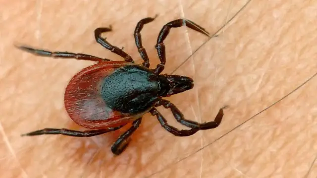 Wie viel Beine hat eine Zecke? Überraschende Fakten zur Zeckenanatomie