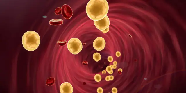 Jak obniżyć cholesterol na diecie keto? Skuteczne strategie i porady