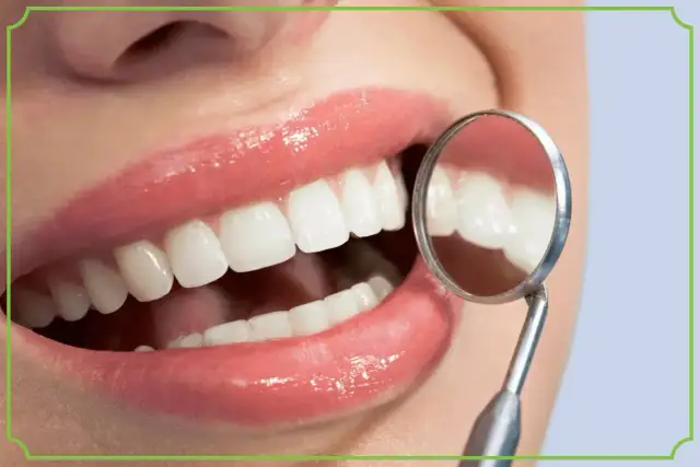 Biała dieta po wybielaniu zębów? Uśmiech jak z reklamy, lśniące zęby odbijają się w lusterku dentystycznym.