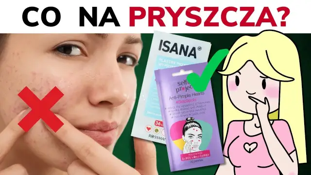 Co na rozdrapane pryszcze? Skuteczne metody na zdrową skórę