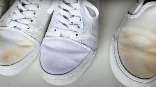 Żółte plamy po praniu? Uratuj białe buty! Skuteczne triki eksperta