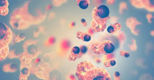 Rak żołądka objawy forum – nie ignoruj tych sygnałów zdrowotnych