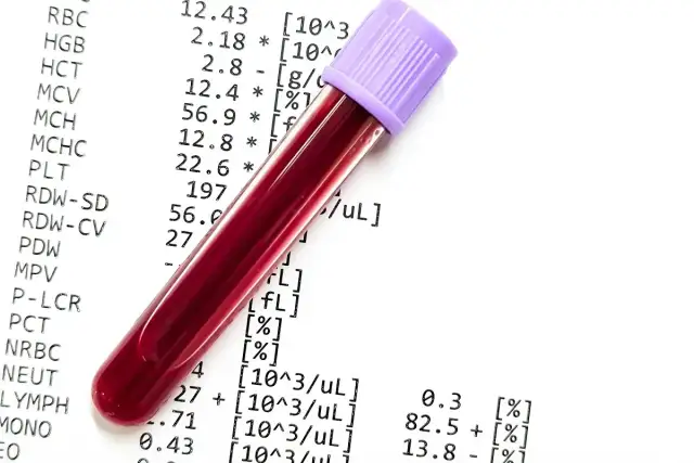 Probówka z krwią na tle wyników badań. Czy wyniki mieszczą się w **norma**?